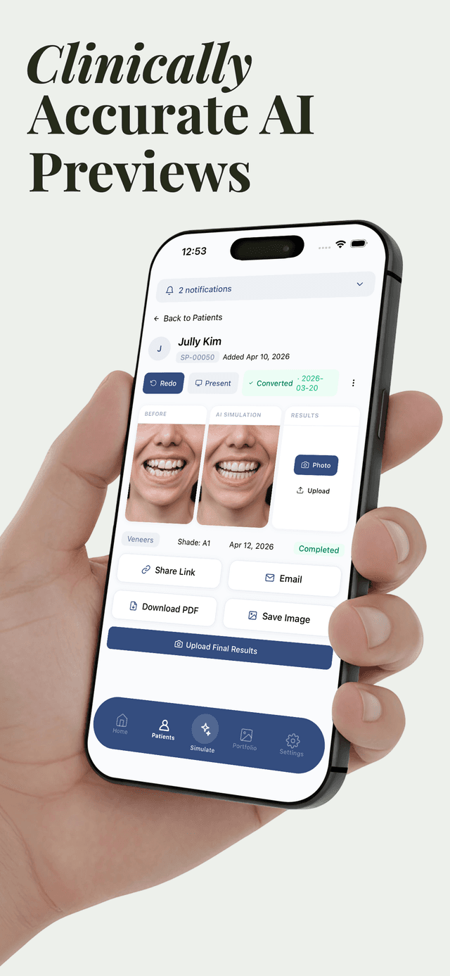 Before-and-after AI smile preview displayed in the Smile PreVue iPhone app